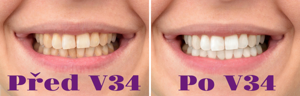 V34 Bělící Korektor - Dentlux