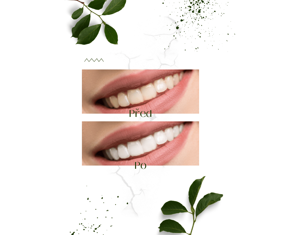 Bělící pudr na zuby - Dentlux