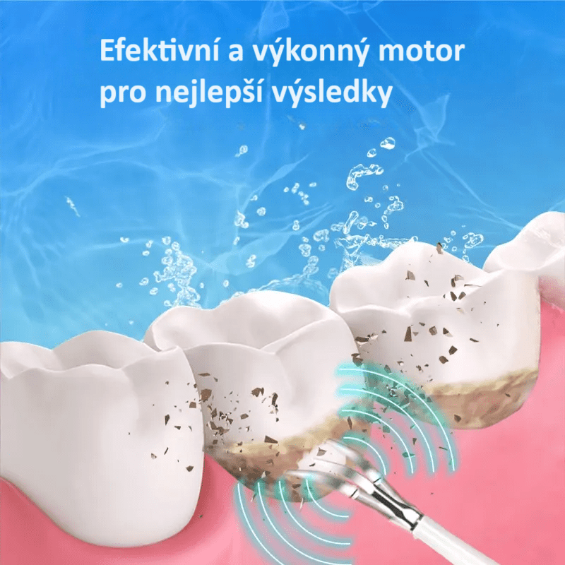 Elektrický sonický odstraňovač zubního kamene - Dentlux